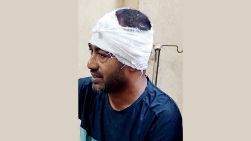হামলার শিকার সাবেক মেয়র ও জাসদ নেতা আনোয়ারুল কবির টুটুল